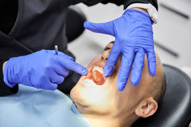Best Emergency Dentist for Lost Fillings or Crowns in Akron, IN